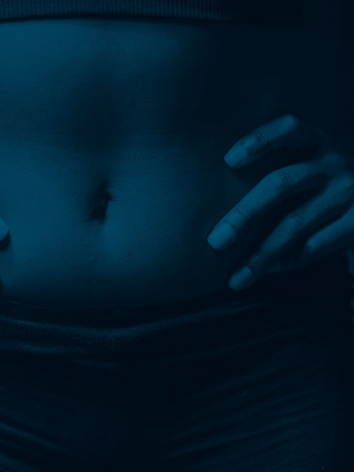 MPRG_Uterine_Fibroids